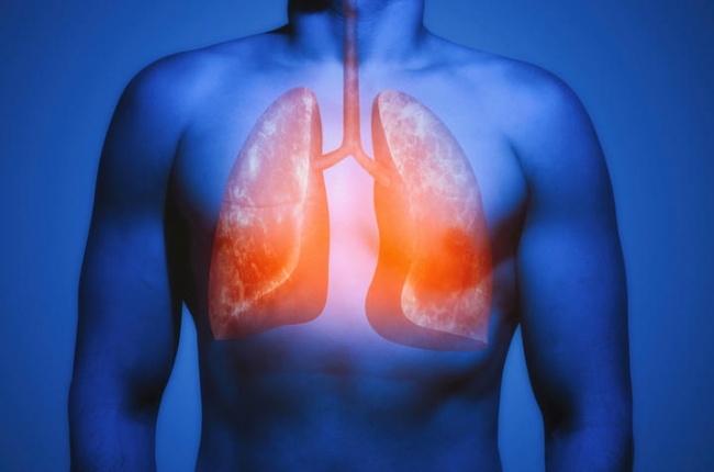 Researchers Identify New Way to Detect Lung Disease